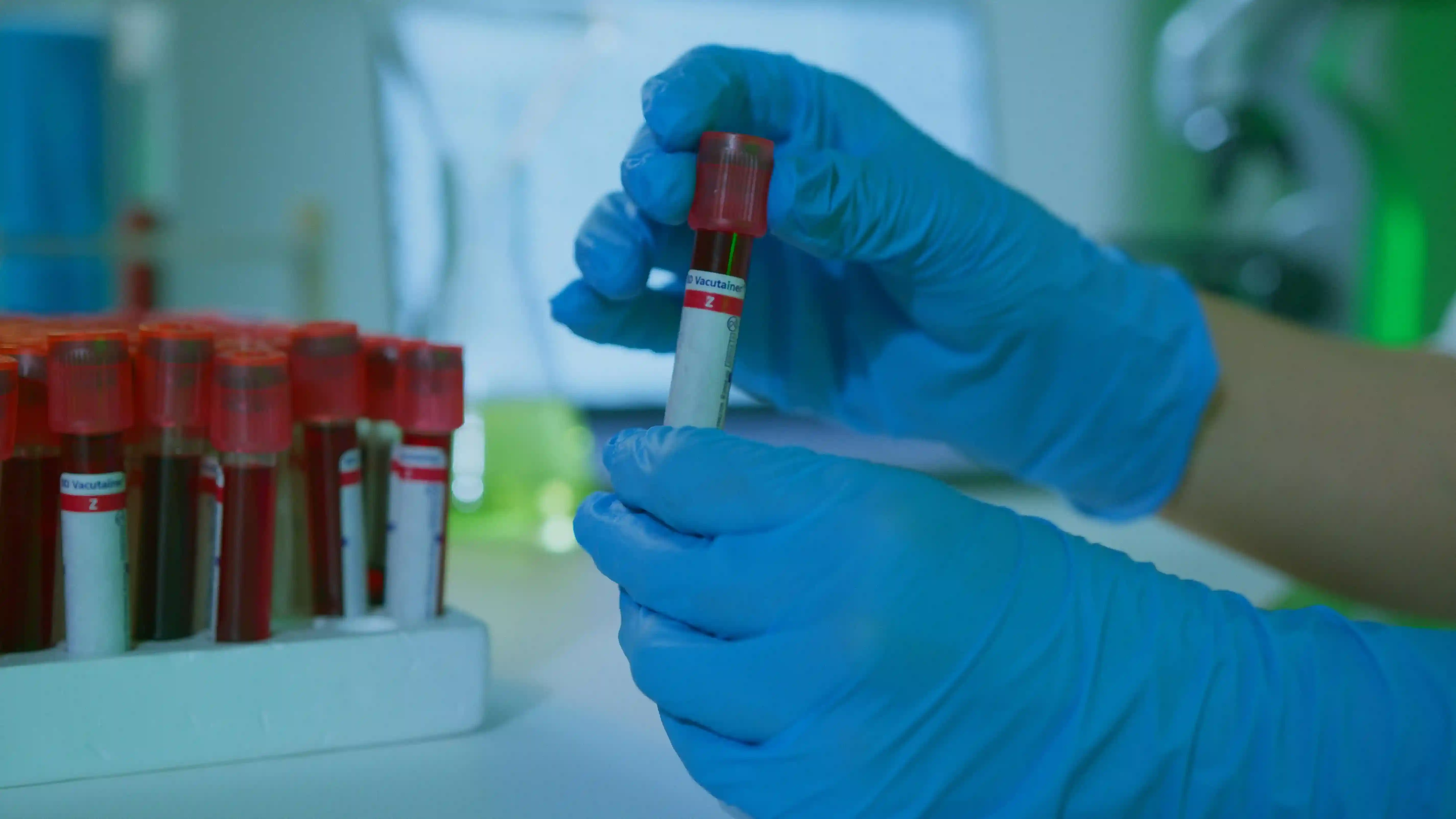 Diagnostic lab near me Gani Hospitals lab blood sample pickup Ramnad lab test at home